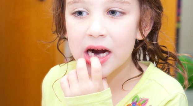 Süt dişleri tedavi edilmese olur mu?